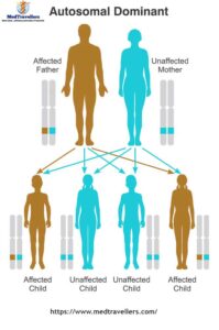 Get Successful Treatment of Muscular Dystrophy in India