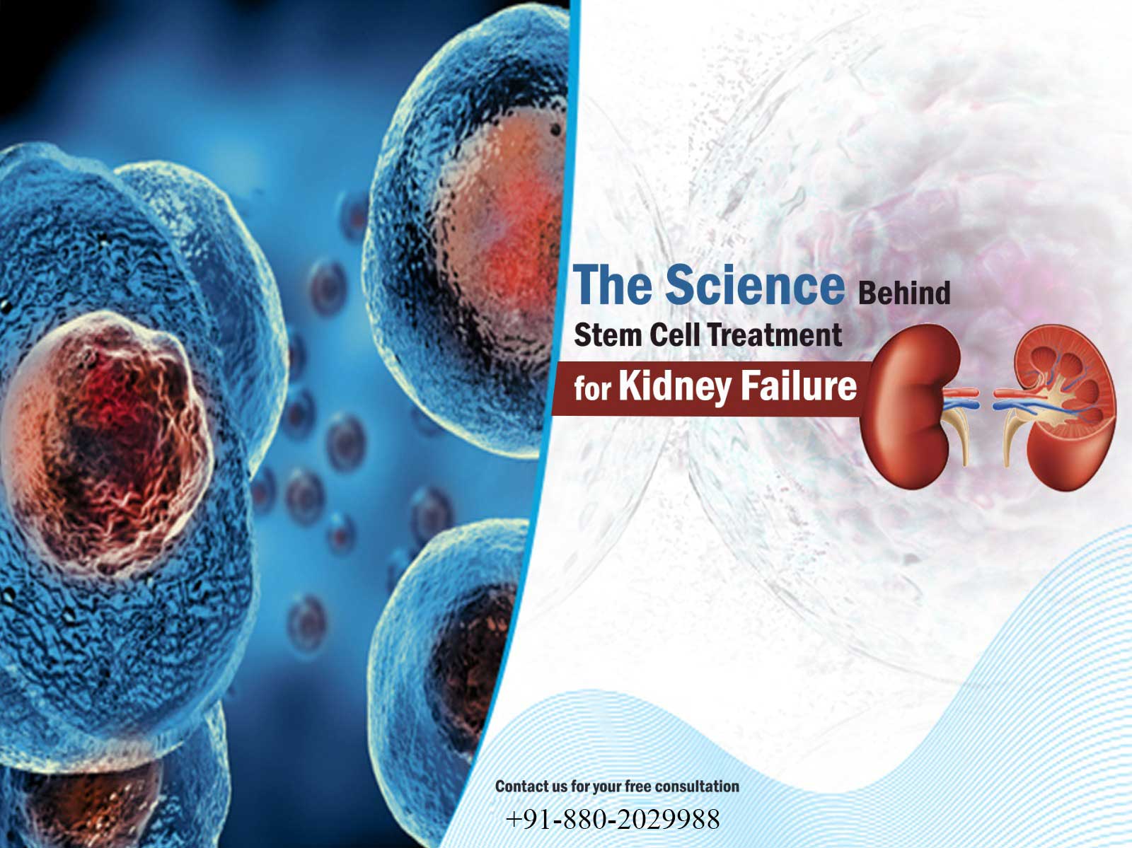 Stem Cell Therapy for Kidney Failure in India: Pros & Cons – Stem Cell ...