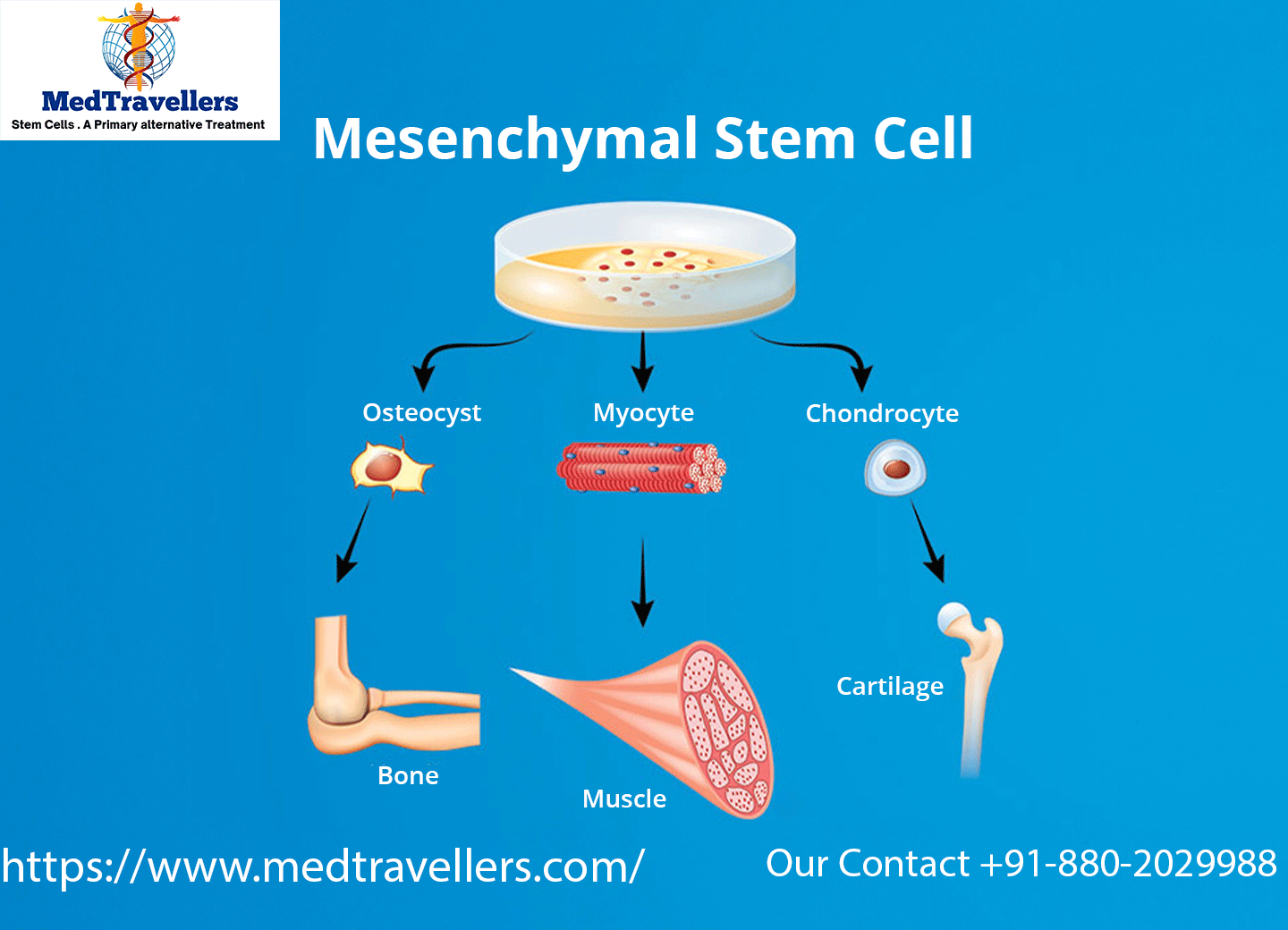What Is a Mesenchymal Stem Cell - Med Travellers Our Contact +91-880-2029988