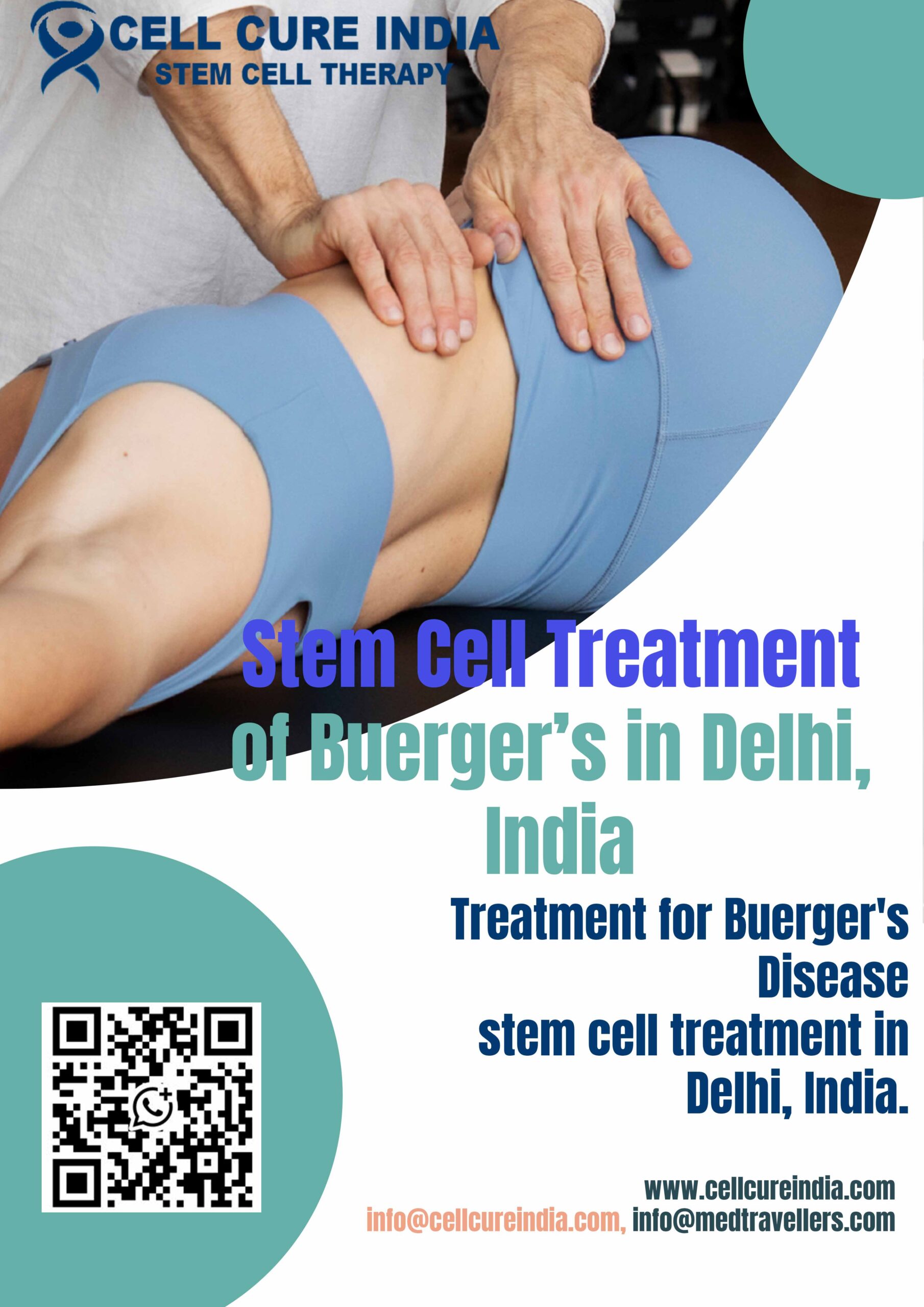Stem Cell Treatment of Buerger's Disease in India: A Hopeful Path to Healing 