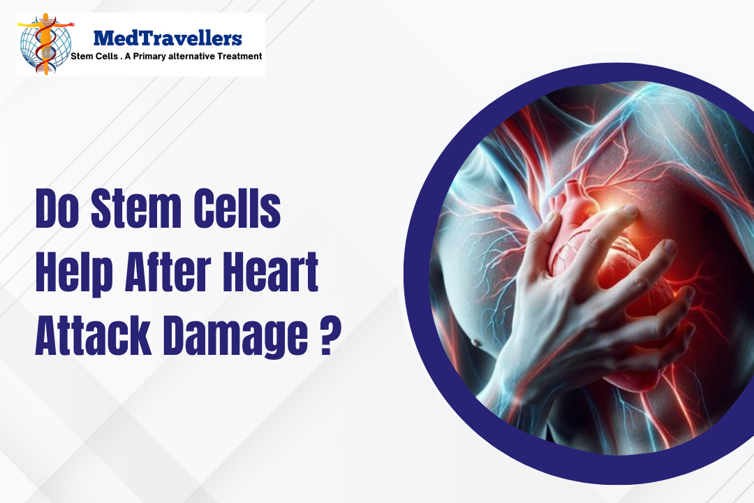 Do Stem Cells Help After Heart Attack Damage